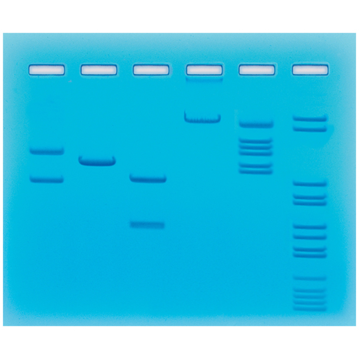 PCR