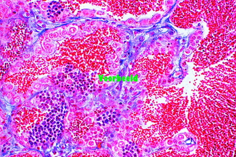 Cyprinus, karper, dwarsdoorsnede testis