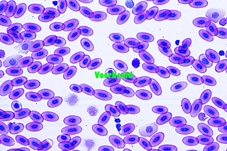 Gallus, kip, bloeduitstrijkje