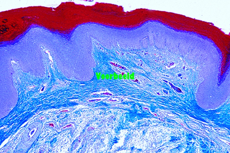 Gallus, kip, ongevederde huid van voet