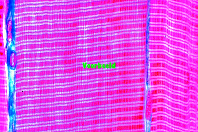 Preparaat spier dwarsgestreept kat