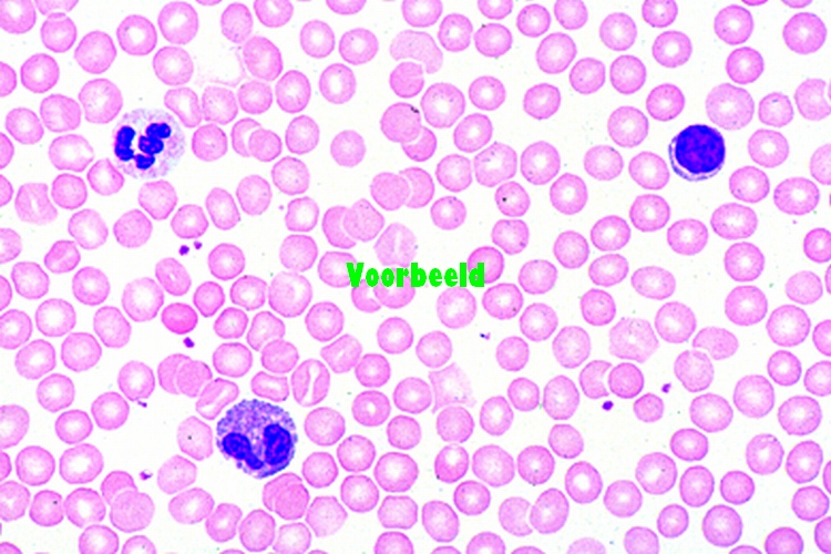 Bloeduitstrijkje, mens