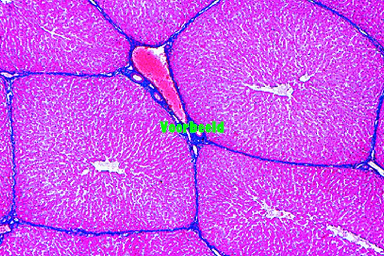 Lever van varken, dwarsdoorsnede
