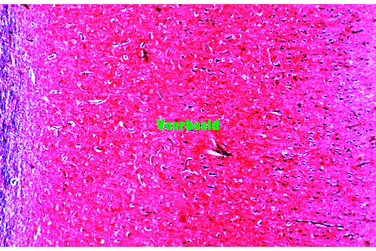 Cerebrum van kat, dwarsdoorsnede