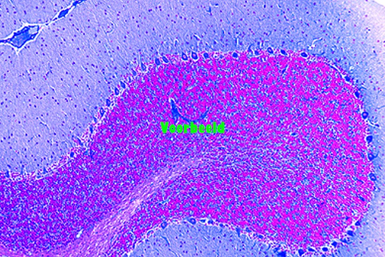 Cerebellum van kat, dwarsdoorsnede