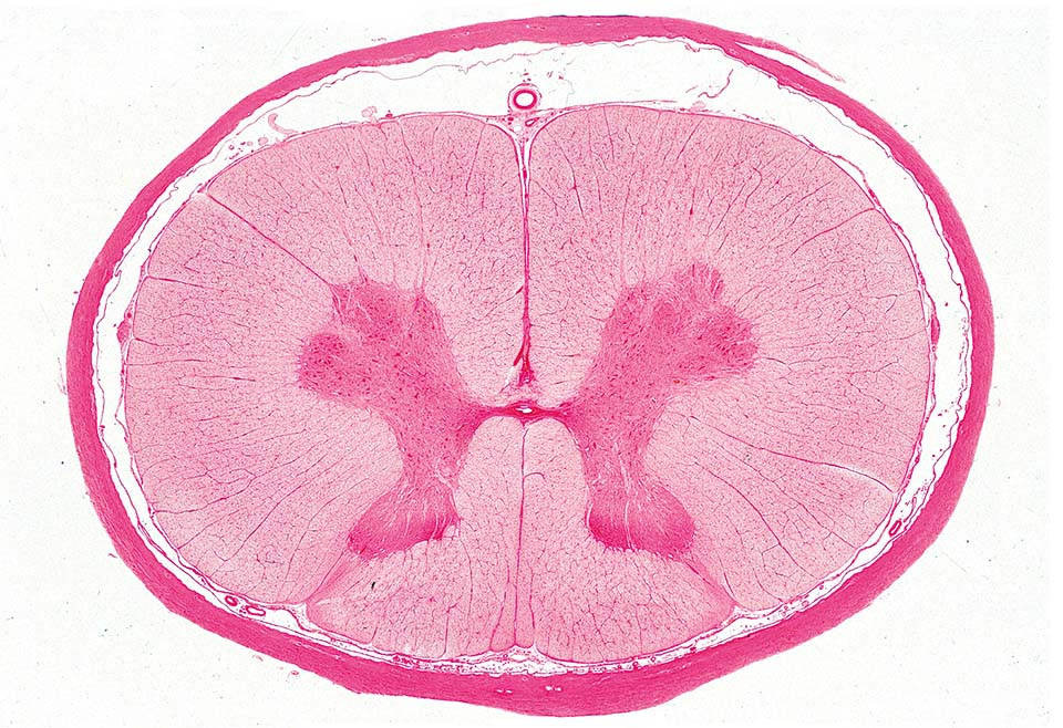 Ruggenmerg van kat, dwarsdoorsnede