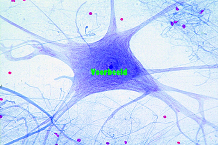 Motorische zenuwcellen