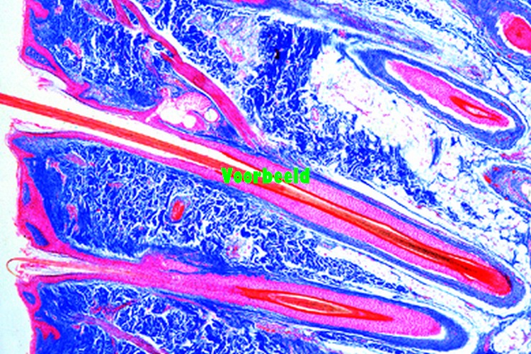 Hoofdhuid, mens, haarfollikels