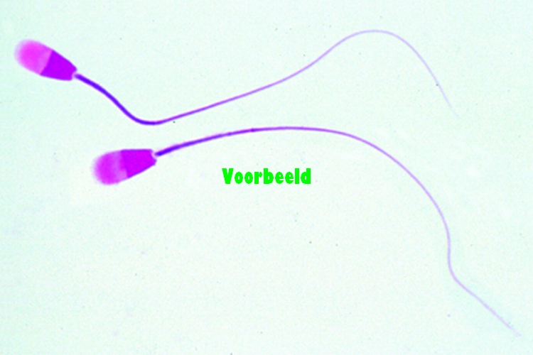 Sperma-uitstrijkje van stier
