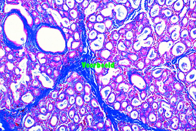 Borstklier van koe, dwarsdoorsnede
