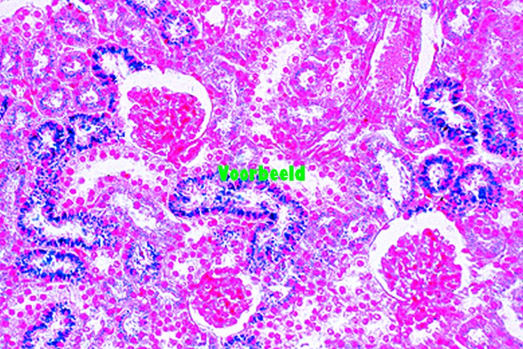 Nier dwarsdoorsnede, vitaal gekleurd