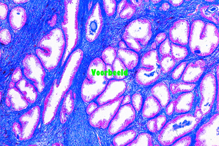 Prostaatklier van varken, dwarsdoorsnede