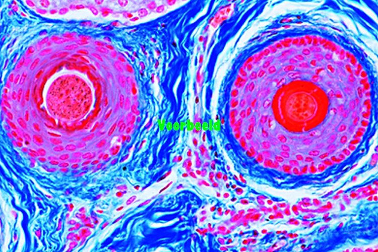 Hoofdhuid, mens, dwarsdoorsnede