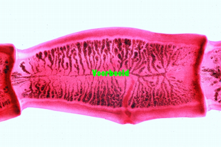 Tapeworm (Taenia), mature proglottid w.m