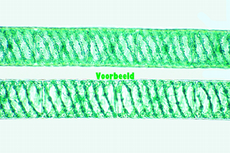 Spirogyra