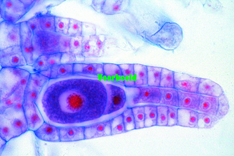 Marchantia