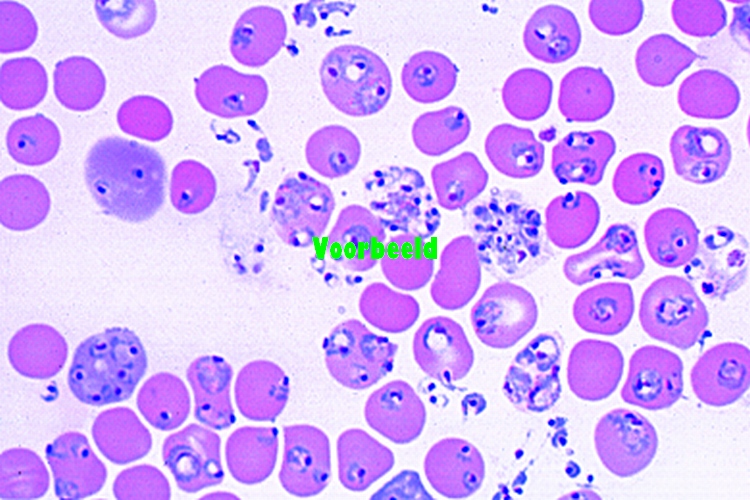 Plasmodium berghei