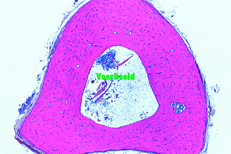 Preparaat botweefsel l.s. + c.s.