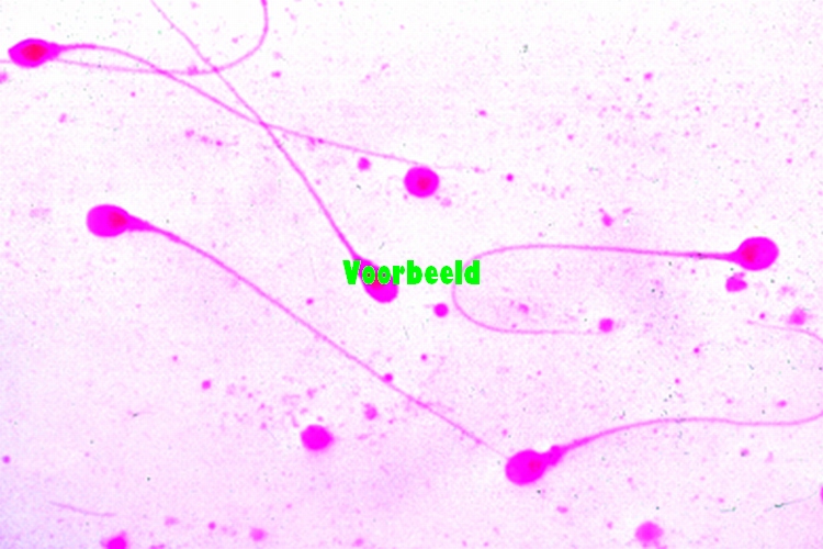 Menselijke histologie uitbreidingsset 2, individueel