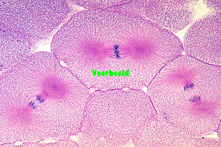 Mitotic stages in sec. of whitefish blas
