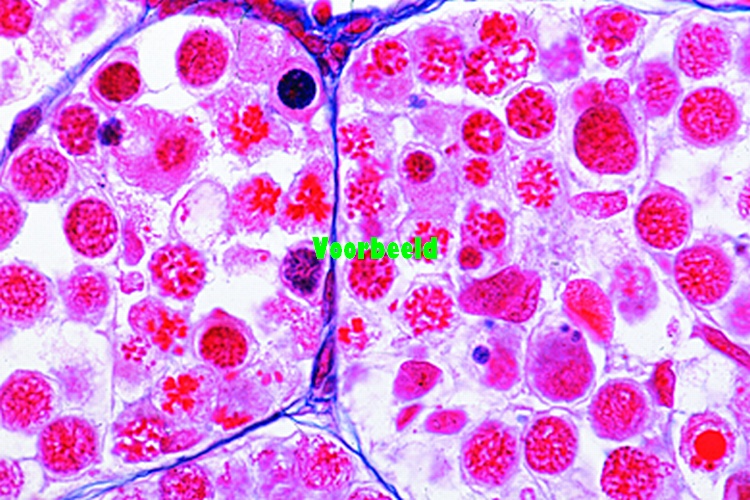 Meiotic (maturation) stages in sec. thro