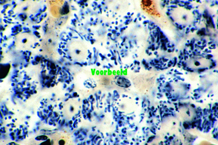 Mitochondria in thin sec. of kidney or l