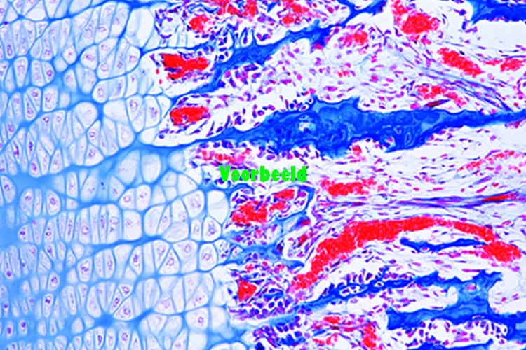 Bot, ontwikkeling foetale vinger of teen