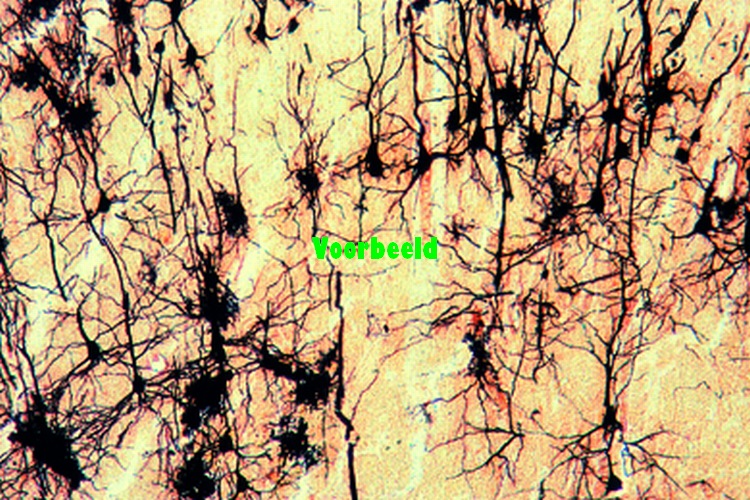 Piramidecellen grote hersenen schors