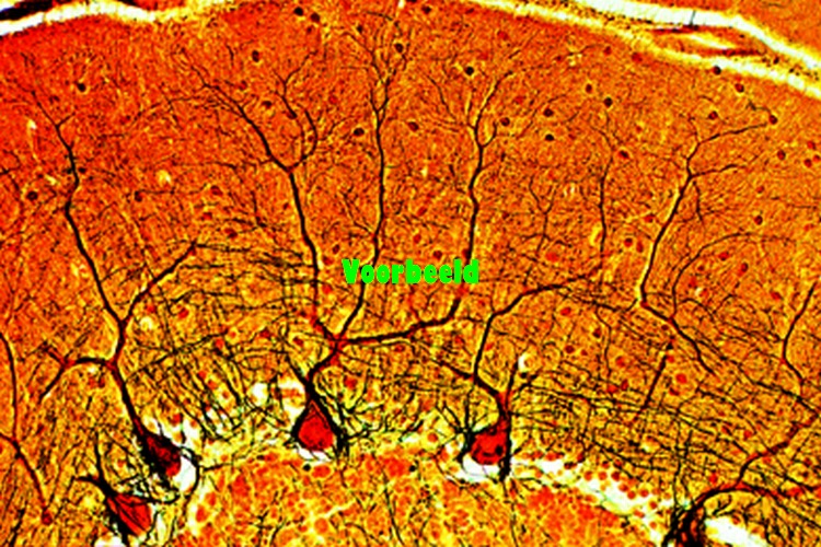 Purkinjecellen kleine hersenen kat