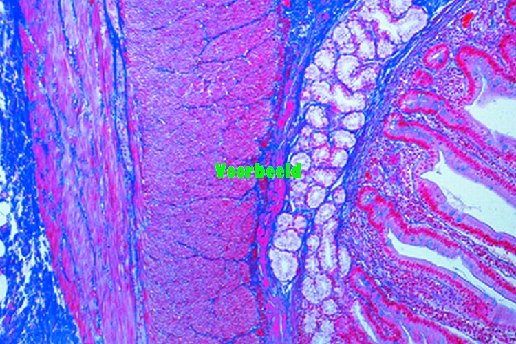 Duodenum