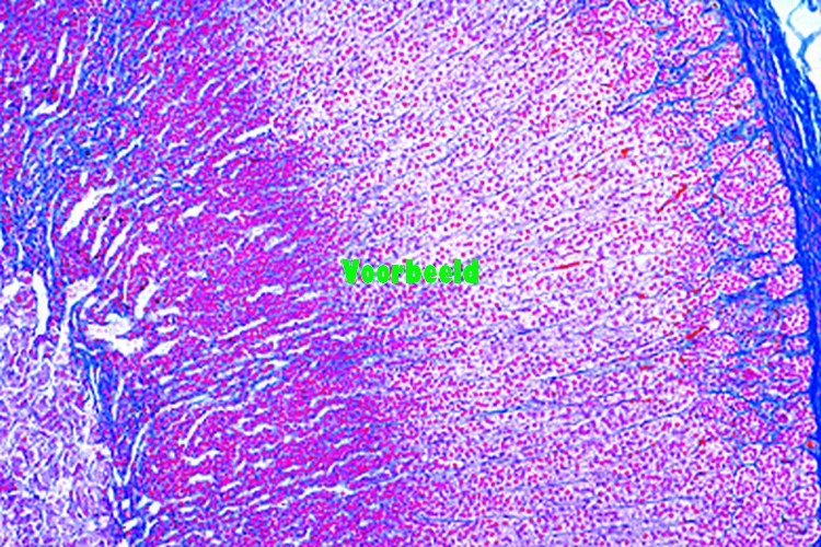 Motorische zenuwcellen, uitstrijkje koe