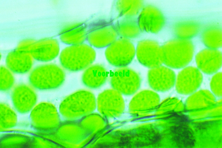 Sectie van lever of nier