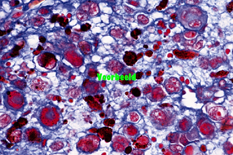 Psammechinus miliaris