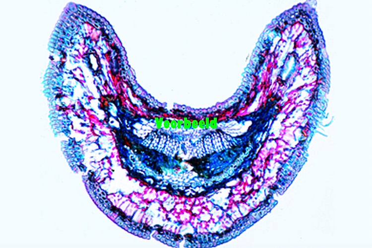 Bacteria in afvalwater