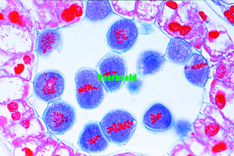 Meiose, dwarsdoorsnede van leliebloemkno