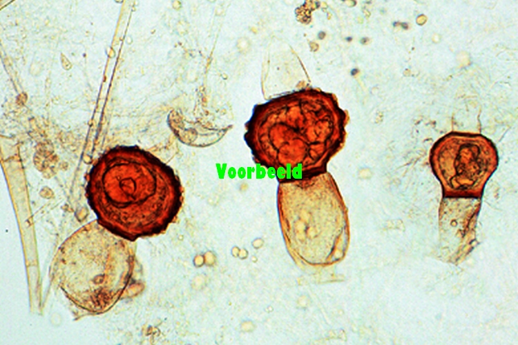 Mucor of Rhizopus