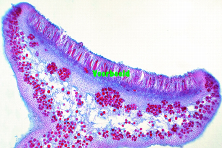 Physcia Apothezium