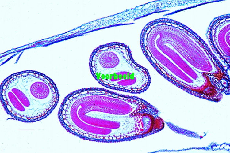 Capsella bursa pastoris