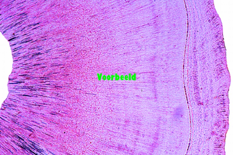 Tooth human, t.s. of crown