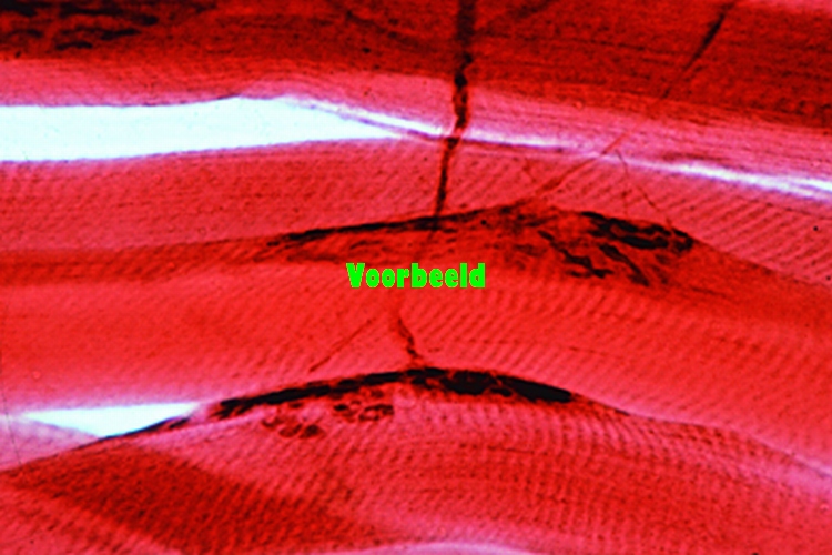 Motorische eindplaten in spier