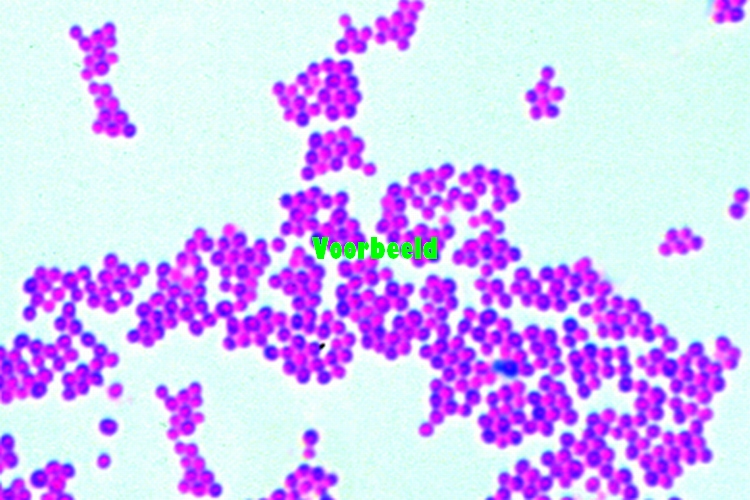 Staphylococcus aureus